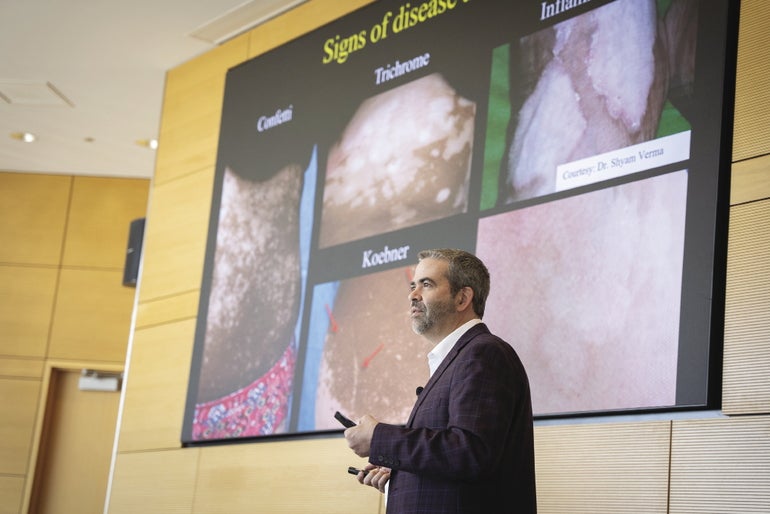A man in a dark grey suit presents in front of a large screen showing images of vitiligo